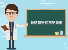 【醫(yī)療科普】骨盆骨折的常見類型有哪幾種？