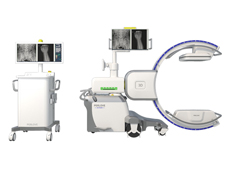三維C臂影像導(dǎo)航系統(tǒng)在骨科手術(shù)中的應(yīng)用優(yōu)勢(shì)體現(xiàn)在哪？