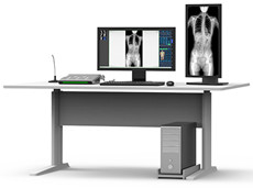 動態(tài)數(shù)字化X線攝影:動態(tài)DR一次成像全脊柱及雙下肢