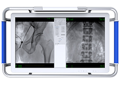 C臂機(jī)的圖像質(zhì)量越用越差? 原因可能是球管的衰減