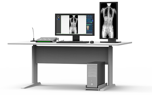 動(dòng)態(tài)DR機(jī)大視野成像 動(dòng)態(tài)DR機(jī)大視野成像