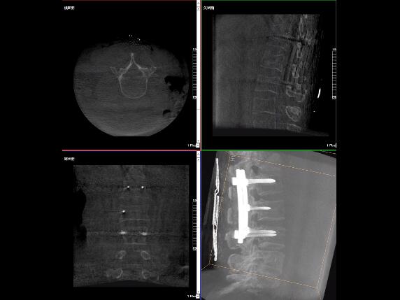 【醫(yī)療科普】2分鐘帶你了解高質(zhì)量X光片的標(biāo)準(zhǔn)是什么？