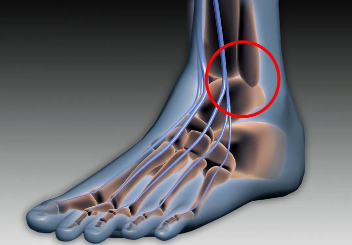 【醫(yī)療科普】：下脛腓關(guān)節(jié)復位