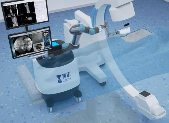 盤點(diǎn)幾款骨科手術(shù)機(jī)器人品牌 盤點(diǎn)幾款骨科手術(shù)機(jī)器人品牌