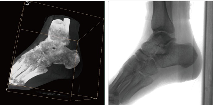 移動(dòng)三維C形臂平板拍攝圖像 移動(dòng)三維C形臂平板拍攝圖像