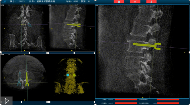 骨科機器人路線規(guī)劃 骨科機器人路線規(guī)劃