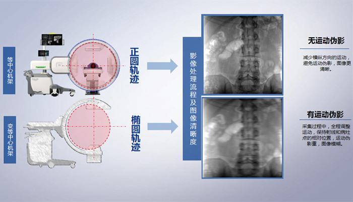 三維C臂的機架設(shè)計 三維C臂的機架設(shè)計