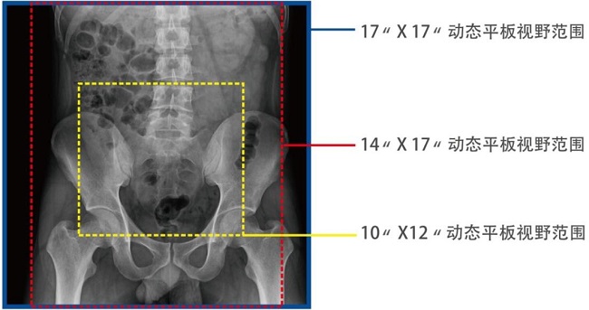 動(dòng)態(tài)DRF的平板
