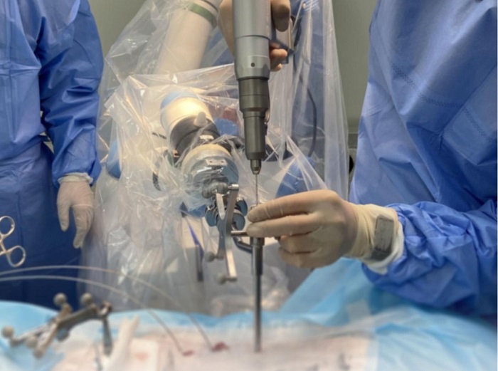 脊柱外科手術(shù)導航定位系統(tǒng)